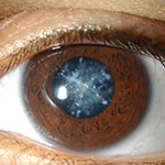 چشم پزشک